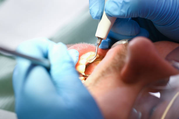 Best Emergency Root Canal Treatment in Three Rivers, MI