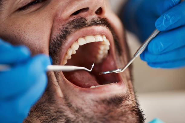 Best Emergency Tooth Extraction in Three Rivers, MI
